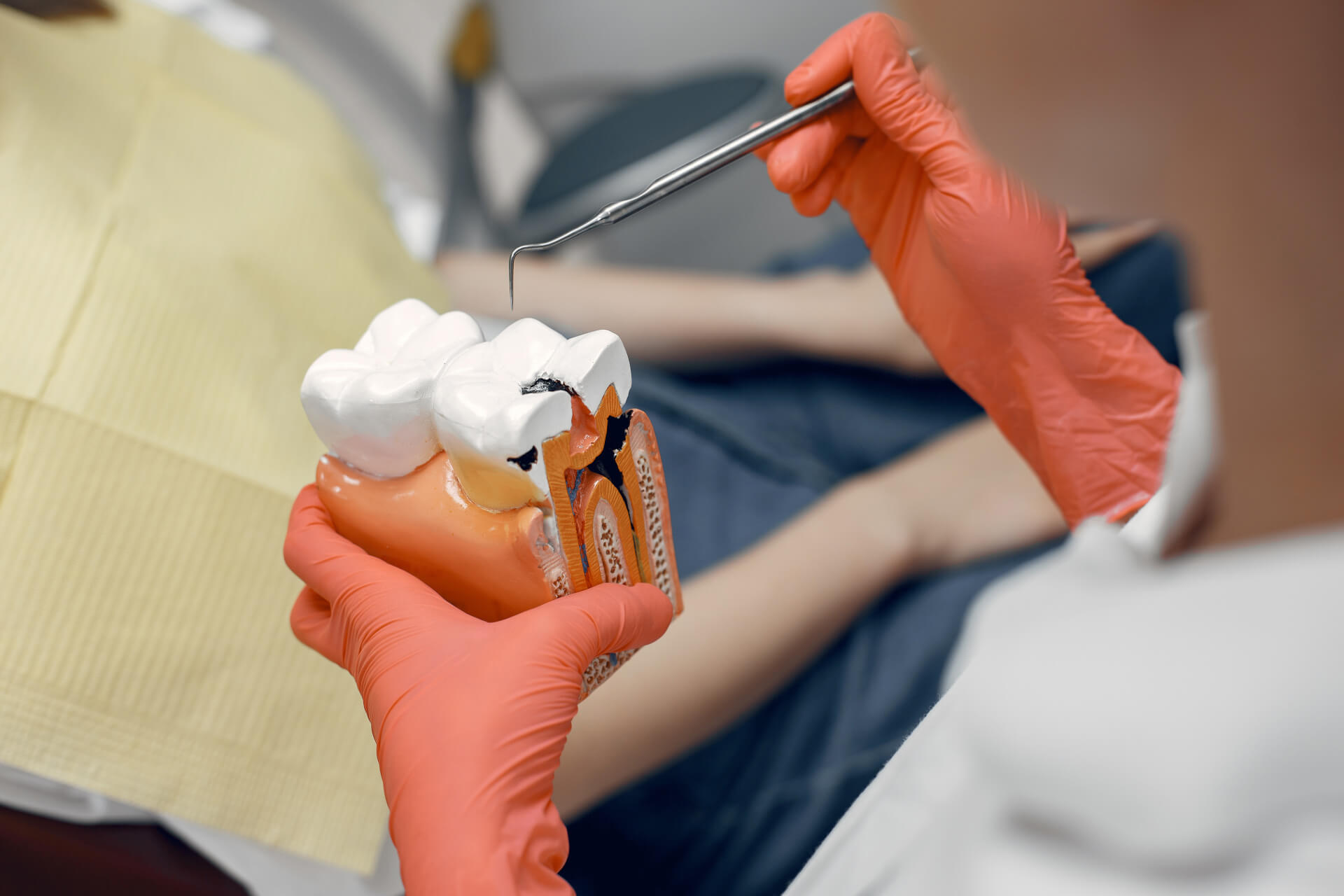 Pentingnya Perawatan Endodonti yang Perlu Anda Ketahui